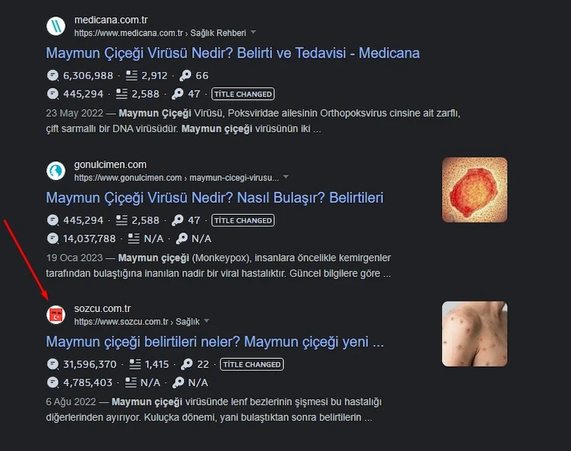 maymun çiçeği aramasında sözcü'nün ilk sayfada yer aldığını gösteren görsel